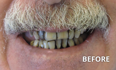 before and after
