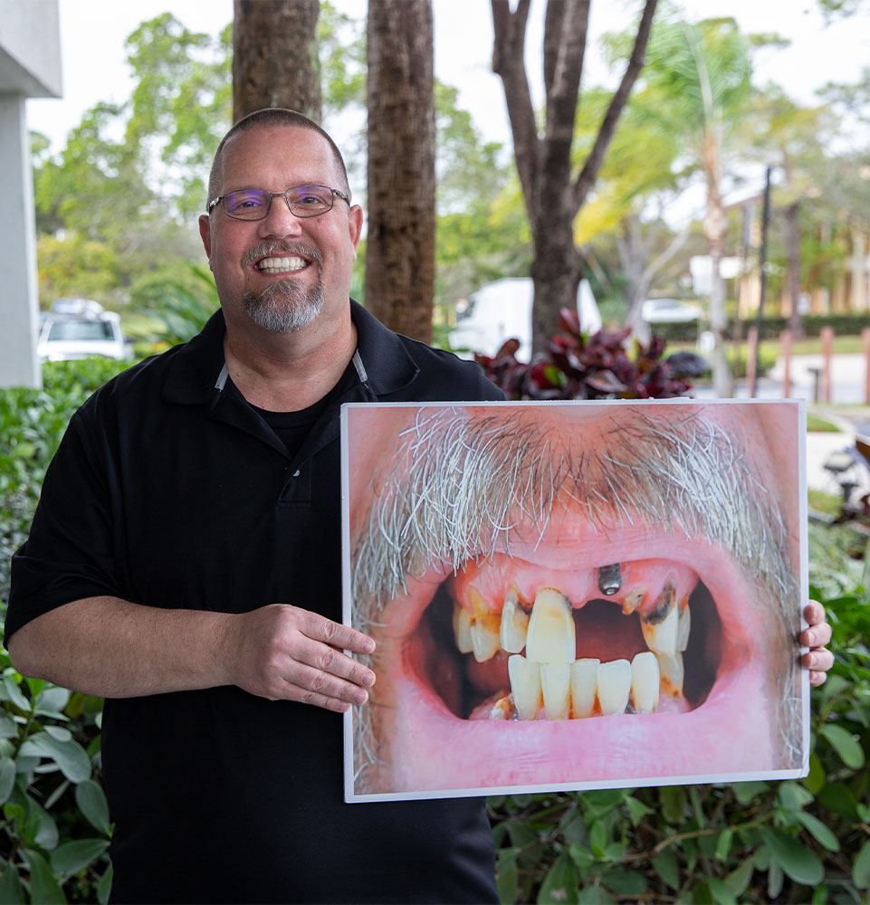 dental patient holding up before and after photo