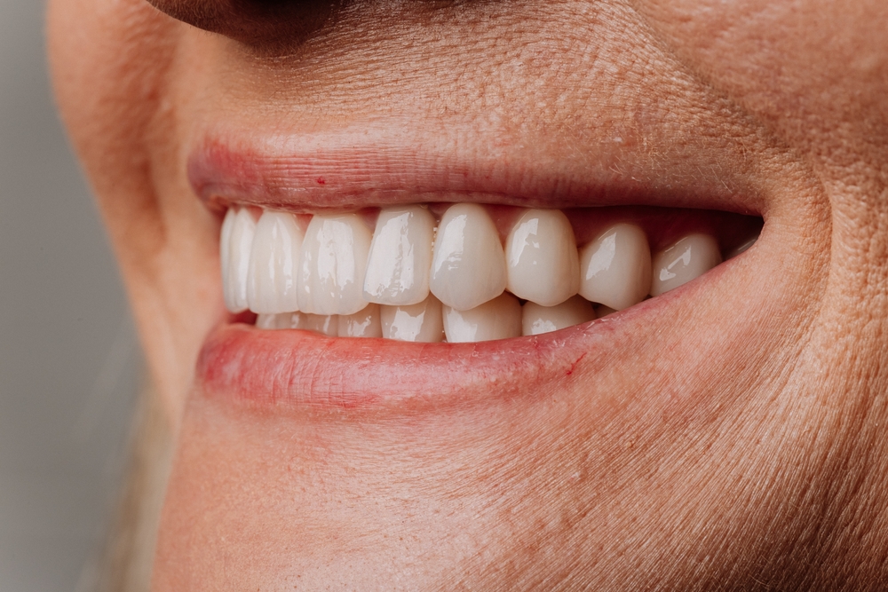 close up photo of white teeth smiling face