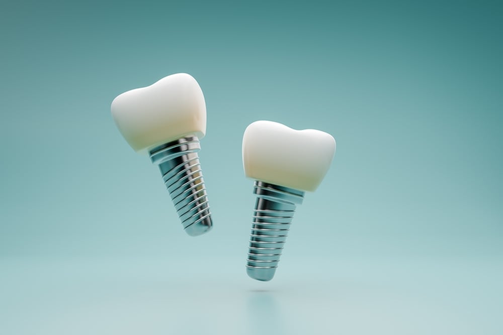 A dentist is placing a "post in tooth" into a prepared root canal, showcasing the process of reinforcing a tooth for a crown. No text on image.