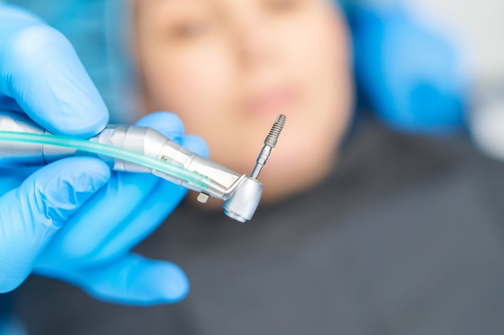 A dentist in blue gloves holds a dental drill and focuses on an implant, with a patient blurred in the background, prepared for a dental implant procedure.